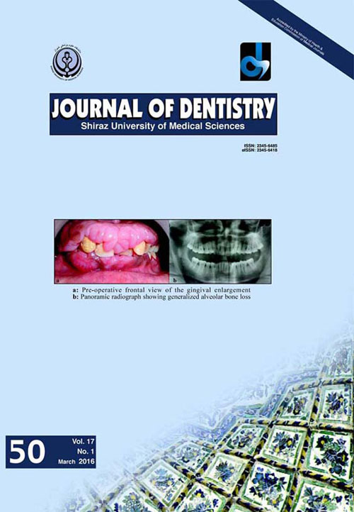 Dentistry, Shiraz University of Medical Sciences - Volume:17 Issue: 1, Mar 2016