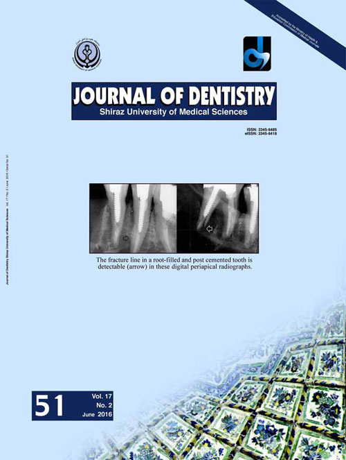 Dentistry, Shiraz University of Medical Sciences - Volume:17 Issue: 2, Jun 2016
