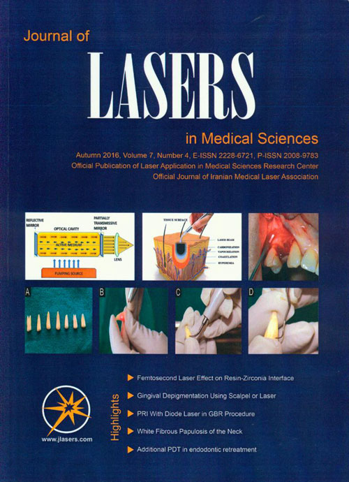 Lasers in Medical Sciences - Volume:7 Issue: 4, Autumn 2016