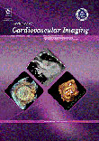 Archives Of Cardiovascular Imaging - Volume:4 Issue: 2, May 2016