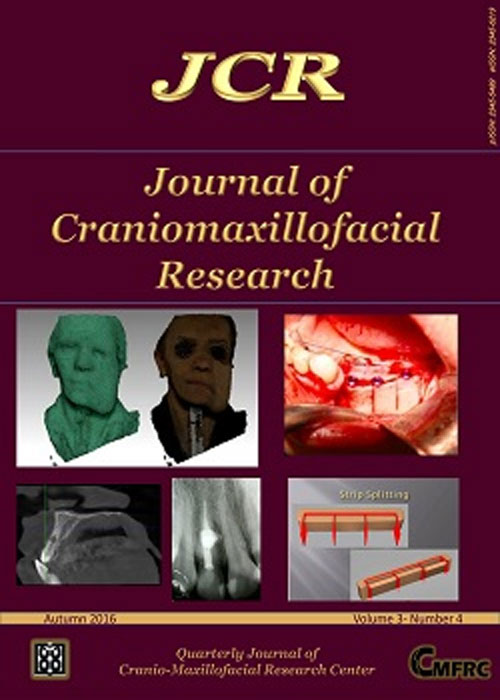 Craniomaxillofacial Research - Volume:3 Issue: 4, Autumn 2016