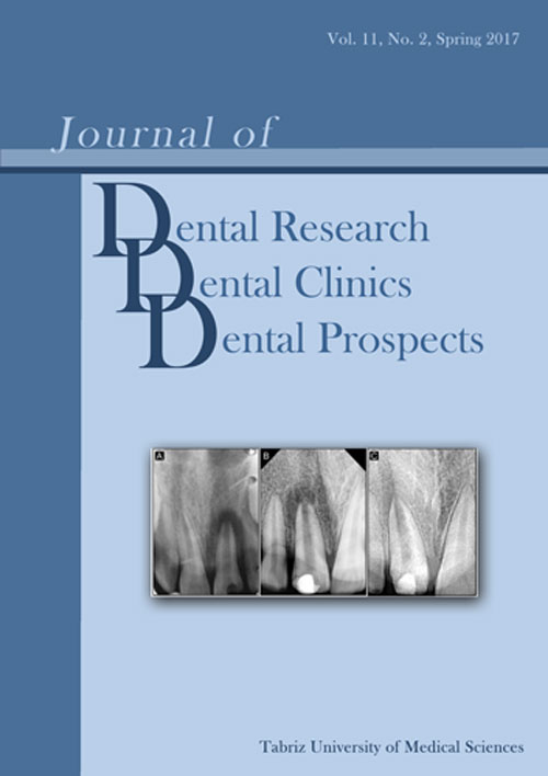 Dental Research, Dental Clinics, Dental Prospects - Volume:11 Issue: 2, Spring 2017