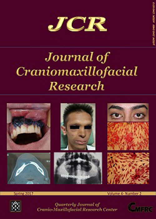 Craniomaxillofacial Research - Volume:4 Issue: 2, Spring 2017