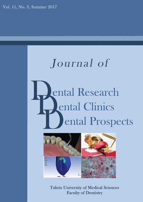 Dental Research, Dental Clinics, Dental Prospects - Volume:11 Issue: 3, Summer 2017