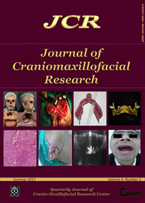 Craniomaxillofacial Research - Volume:4 Issue: 3, Summer 2017