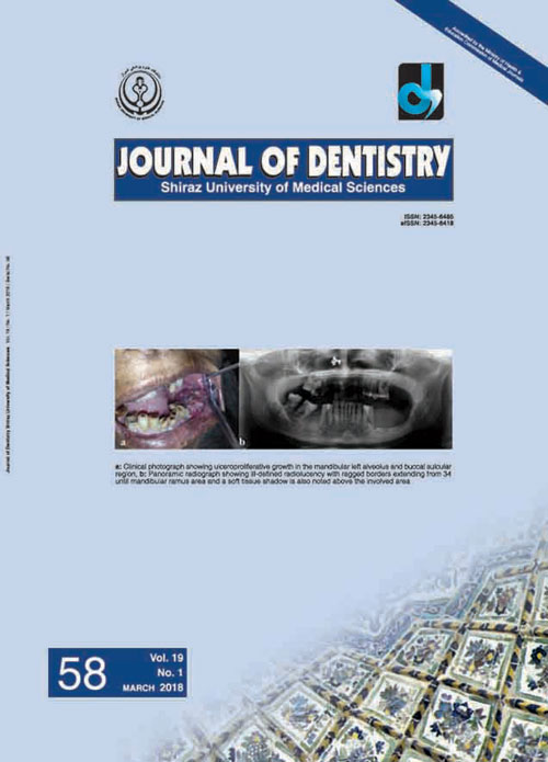 Dentistry, Shiraz University of Medical Sciences - Volume:19 Issue: 1, Mar 2018