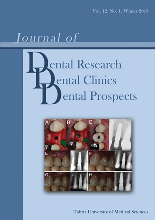 Dental Research, Dental Clinics, Dental Prospects - Volume:12 Issue: 1, Winter 2018