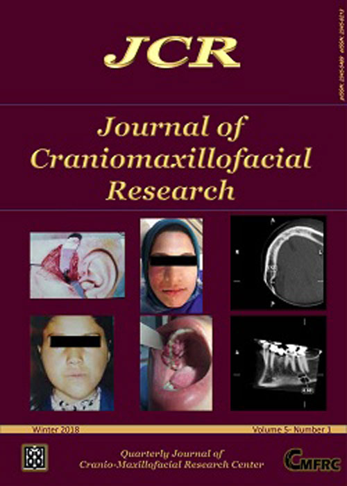 Craniomaxillofacial Research - Volume:5 Issue: 1, Winter 2018