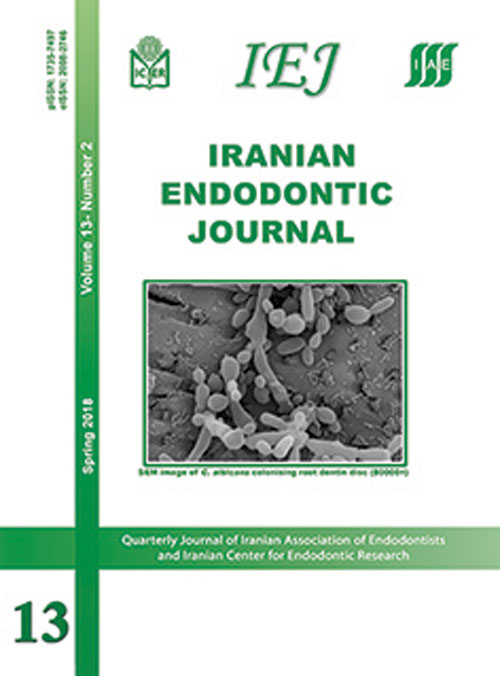 Iranian Endodontic Journal - Volume:13 Issue: 2, Spring 2018