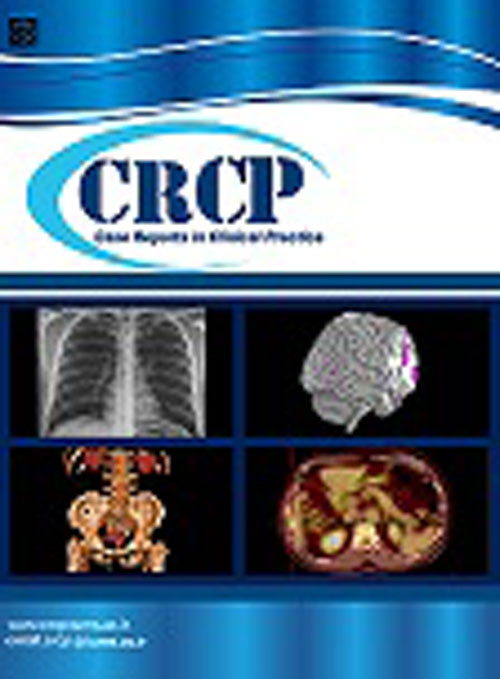 Case Reports in Clinical Practice - Volume:2 Issue: 4, Autumn 2017