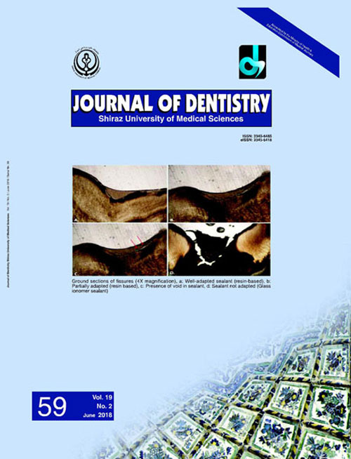 Dentistry, Shiraz University of Medical Sciences - Volume:19 Issue: 2, Jun 2018