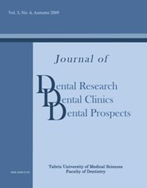 Dental Research, Dental Clinics, Dental Prospects - Volume:12 Issue: 2, Spring 2018
