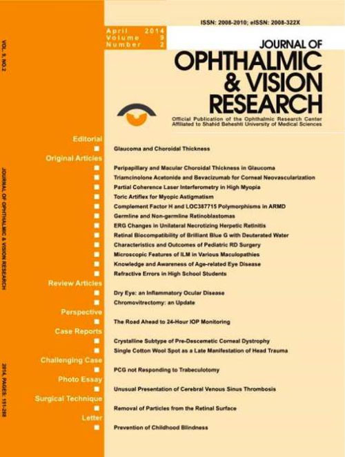 Ophthalmic and Vision Research - Volume:9 Issue: 2, Apr-Jun 2014
