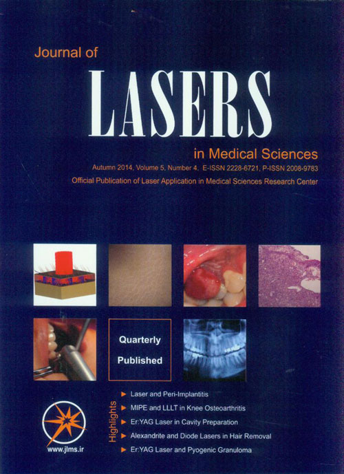 Lasers in Medical Sciences - Volume:5 Issue: 4, Autumn 2014
