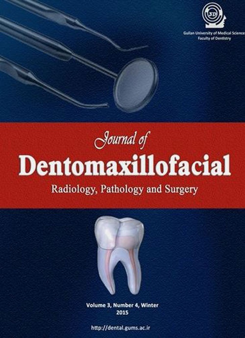 Dentomaxillofacil Radiology, Pathology and Surgery - Volume:7 Issue: 2, Summer 2018