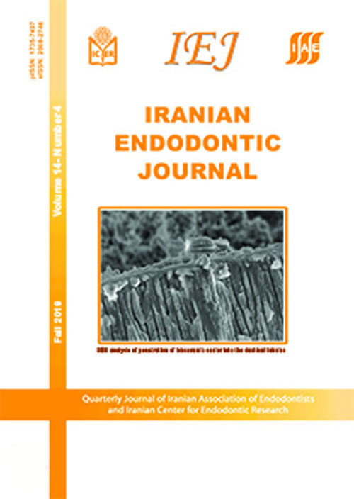 Iranian Endodontic Journal - Volume:16 Issue: 3, Summer 2021