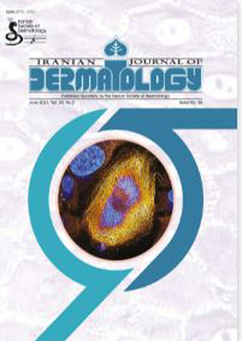 Dermatology - Volume:24 Issue: 2, Spring 2021