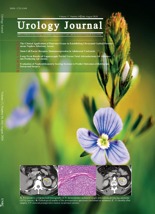 Urology Journal - Volume:19 Issue: 1, Jan-Feb 2022