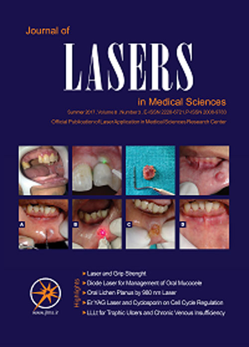 Lasers in Medical Sciences - Volume:13 Issue: 1, Winter 2022