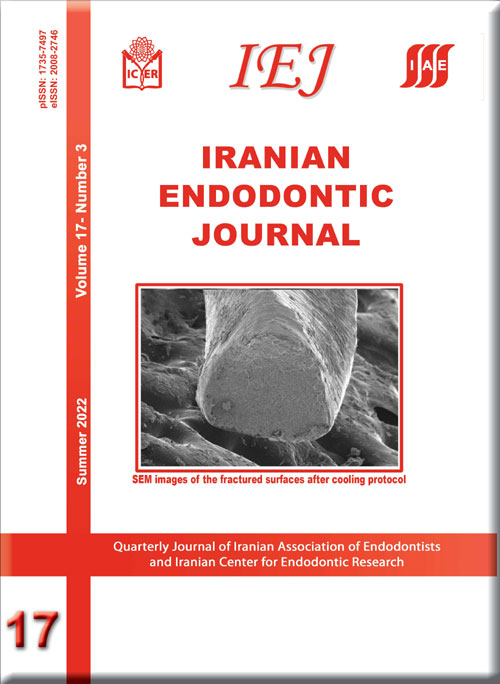 Iranian Endodontic Journal - Volume:17 Issue: 3, Summer 2022