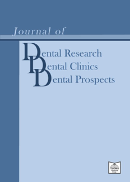 Dental Research, Dental Clinics, Dental Prospects - Volume:16 Issue: 3, Summer 2022