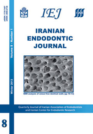 Iranian Endodontic Journal - Volume:8 Issue: 1, Winter 2013