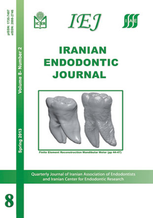 Iranian Endodontic Journal - Volume:8 Issue: 2, Spring 2013