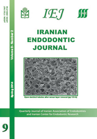 Iranian Endodontic Journal - Volume:9 Issue: 2, Spring 2014