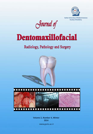Dentomaxillofacil Radiology, Pathology and Surgery - Volume:2 Issue: 4, Winter 2014