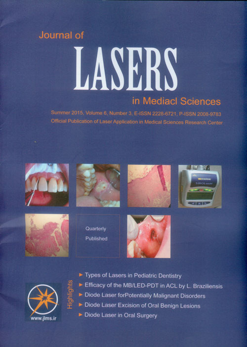 Lasers in Medical Sciences - Volume:6 Issue: 3, Summer 2015